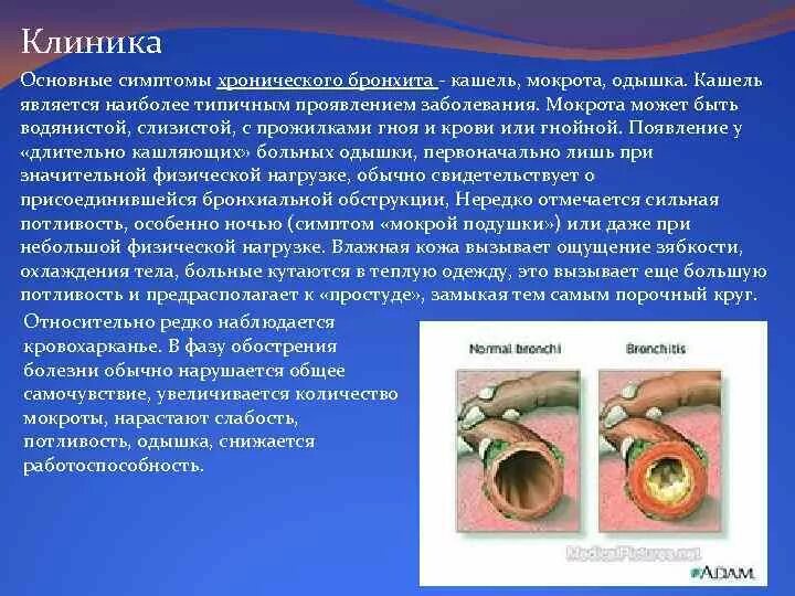 Бронхит заразен или. Хронический бронхит с мокротой кашлем. При хроническом бронхите отмечается кашель с мокротой. При хроническом бронхите кашель отмечается.