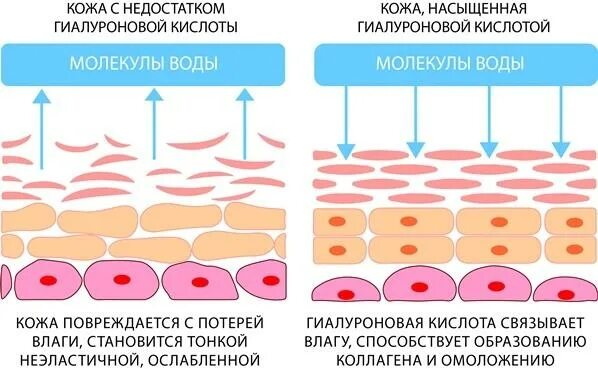 Сколько делать гиалуроновая кислота