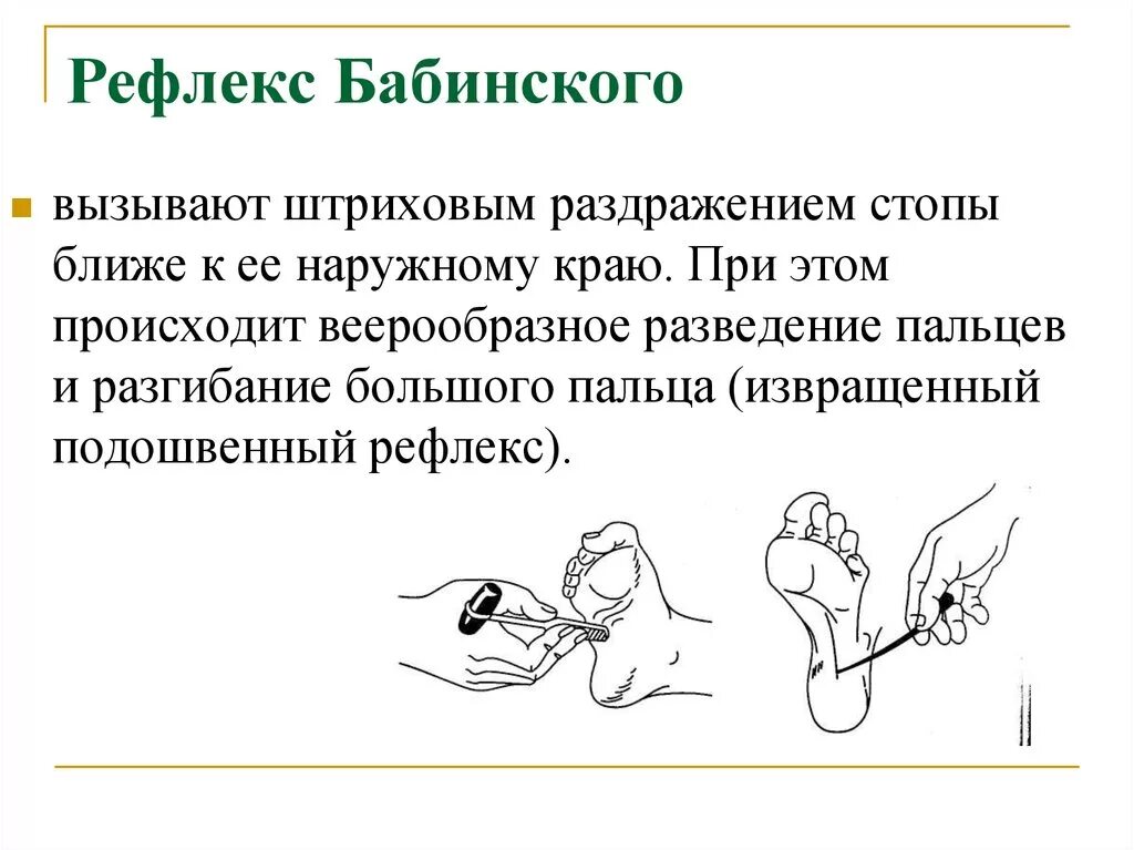 Проверка рефлексов. Патологические рефлексы симптом Бабинского. Подошвенный рефлекс Бабинского. Неврологические рефлекс Бабинского. Рефлекс Бабинского Оппенгейма Гордона.