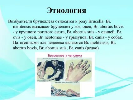 Возбудитель бруцеллеза