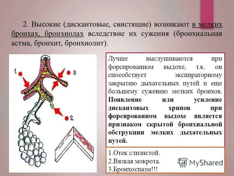 бронхиальная обструкция хрипы. сухие свистящие хрипы. чем лечить свистящие бронхи. хрипы при форсированном выдохе. механизм свистящих хрипов.