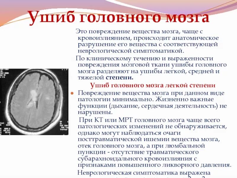 Последствия сотрясения мозгов. Повреждение вещества головного мозга. Закрытая травма головного мозга.