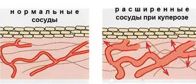 Как понять что проблемы с сосудами