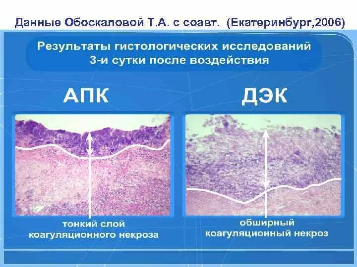 Доброкачественные заболевания шейки. Лейкоплакия шейки матки гистология. Вирусные поражения шейки матки гистология. После ДЭК шейки матки гистология. Лейкоплакия шейки матки гистология описание.