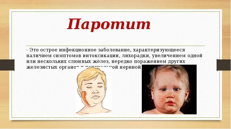 Больной свинкой. Воспаление слюнной железы паротит. Паротит Свинка возбудитель. Эпидемический паротит Свинка симптомы. Симптомы острого эпидемического паротита.