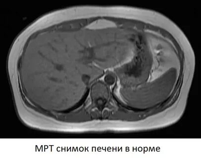Кт и мрт печени