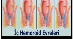 Неміс порно комедиясы