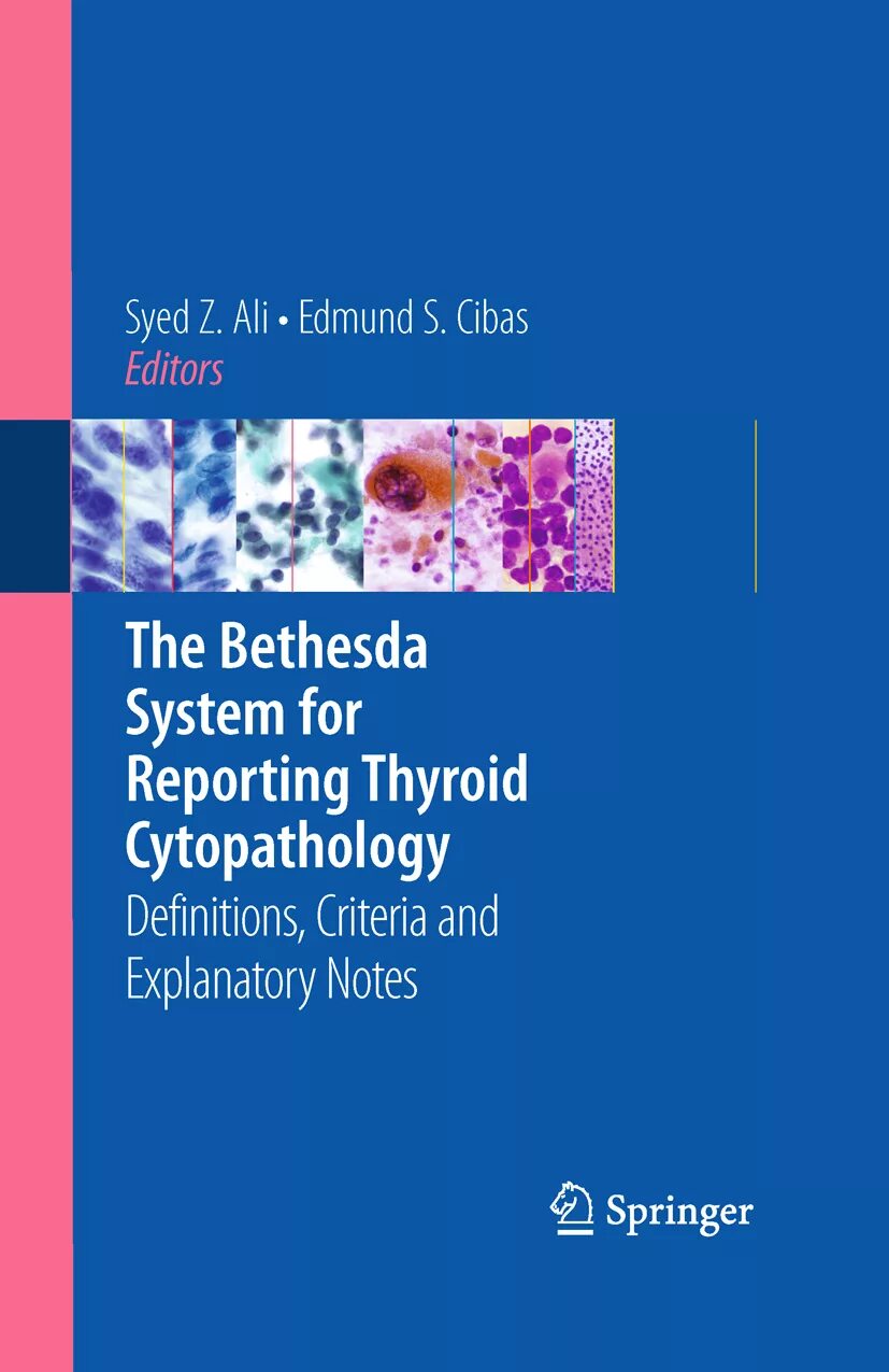 The bethesda system. The Bethesda System for reporting Thyroid Cytopathology. Bethesda Thyroid. Bethesda 2 щитовидной железы. Тест по классификации the Bethesda System for reporting cervical Cytology.