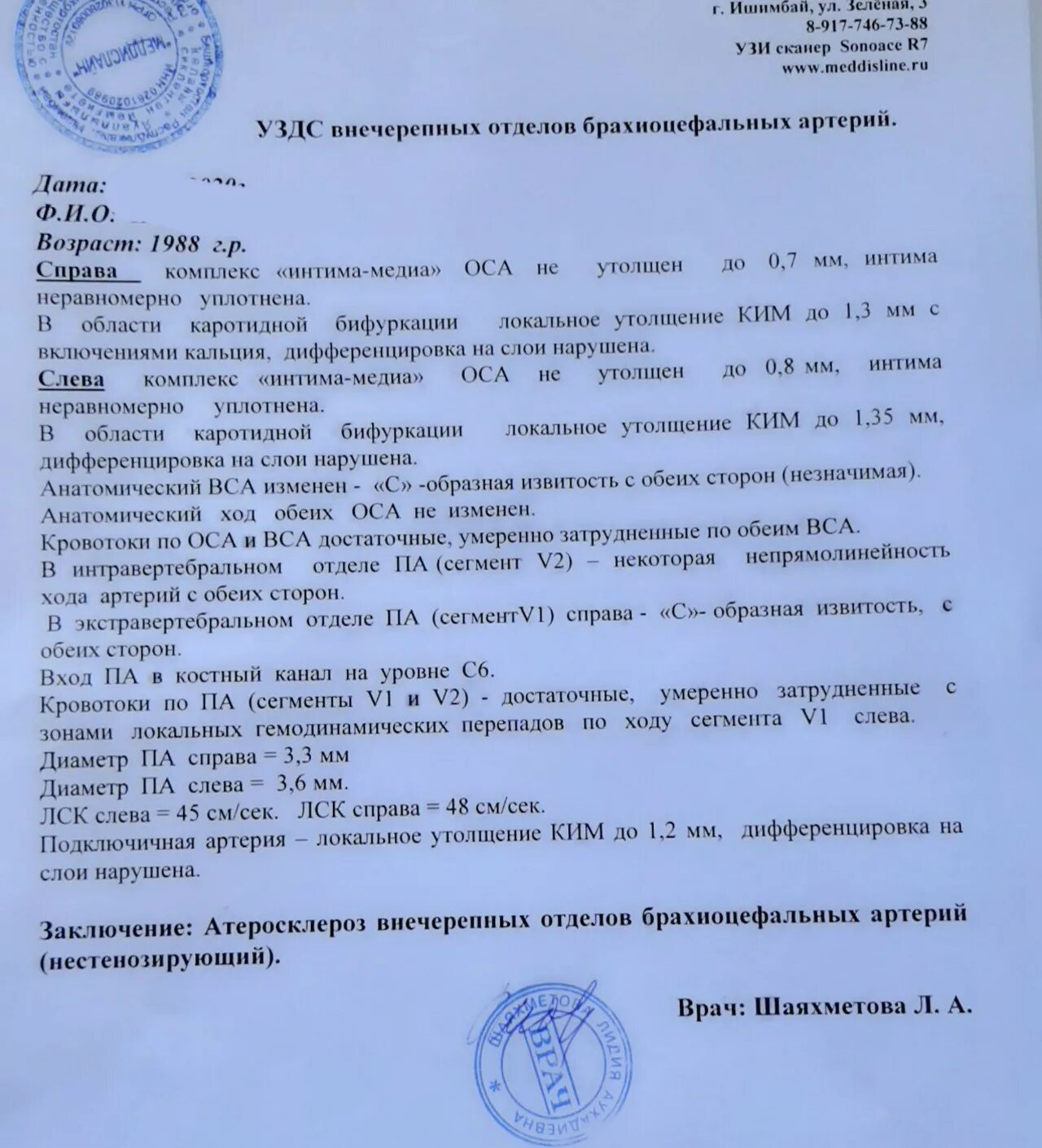 Нестенозирующий атеросклероз бца что это. Протокол УЗИ бца атеросклероз. УЗИ брахиоцефальных артерий заключение атеросклероз. УЗИ сосудов нижних конечностей заключение. УЗИ сонных артерий заключение.