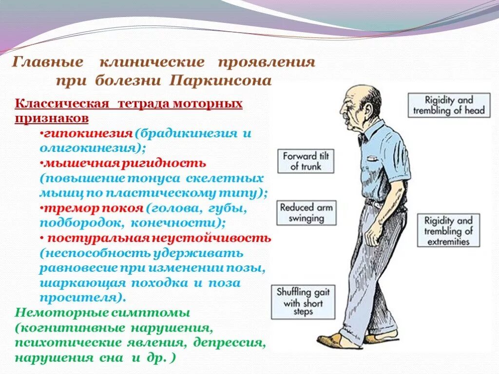 Болезнь паркинсона борьба. Клинические проявления синдрома паркинсонизма. Клинические проявления болезни Паркинсона. Клинические проявления при болезни Паркинсона. Моторные симптомы болезни Паркинсона.