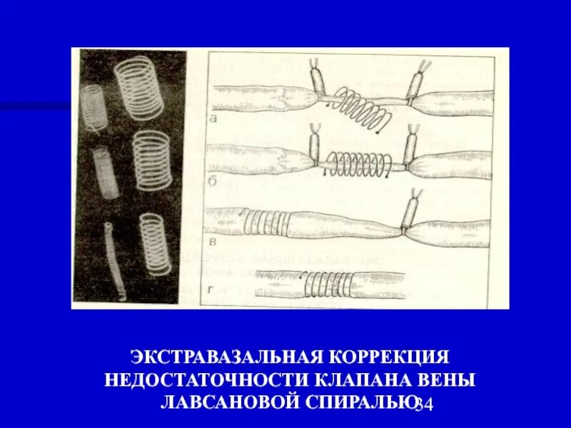 Признаки экстравазального влияния. Экстравазальное пространство это. Признаки экстравазального влияния. Признаки экстравазального влияния. Экстравазальная компрессия.