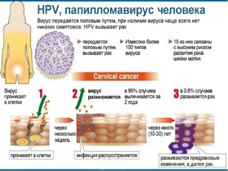 Что вызывает впч. Вирус папилломы человека высокого онкогенного риска. папилломавируса человека. папилломавирус пути передачи. впч онкогенного типа.