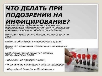 Сдать на зппп