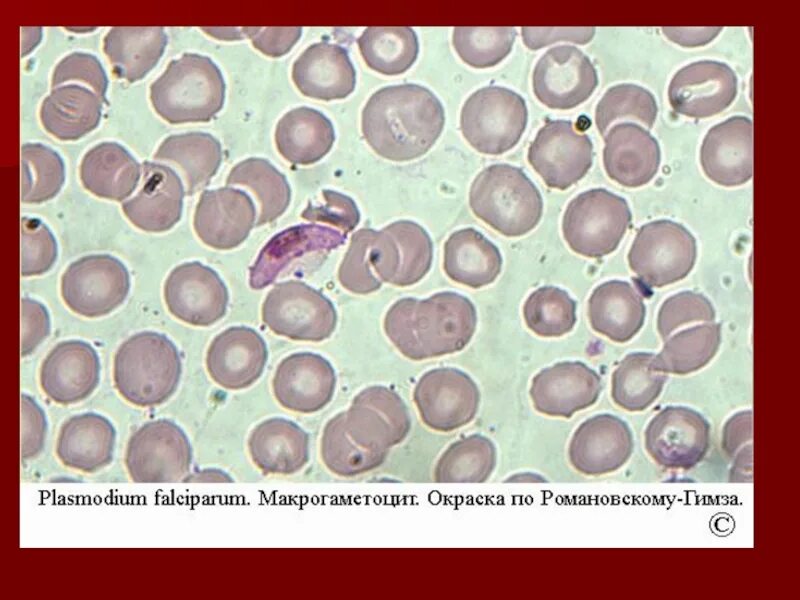 Хламидии Романовскому Гимзе. Малярийный плазмодий препарат. Малярийный плазмодий Романовский Гимзе. Малярийный плазмодий мазок крови. Микрогаметоцит это
