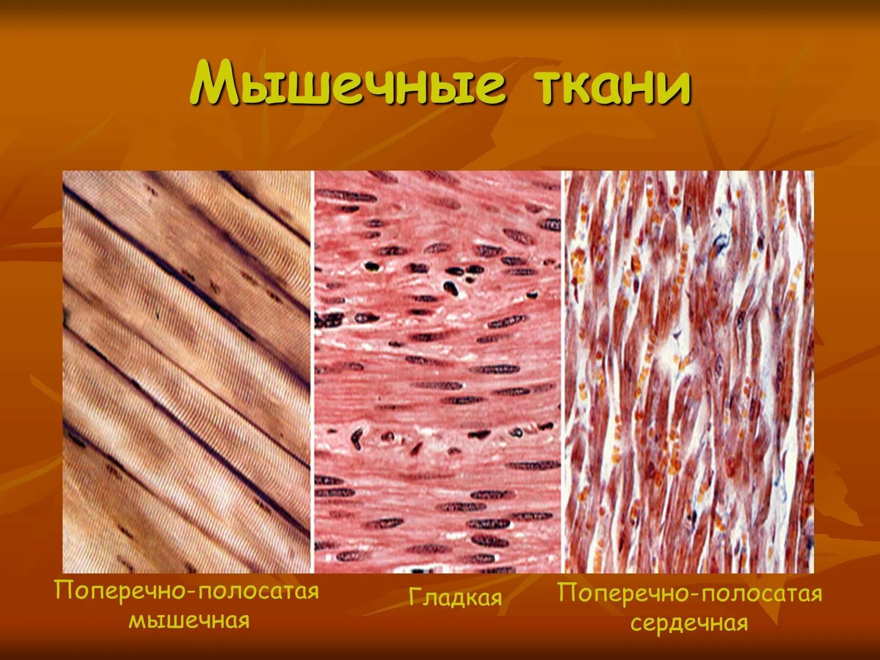 Сердечная мышечная ткань рисунок. Гладкая соединительная ткань. Поперечнополосатая и гладкая мышечная ткань. Гладкая мышечная ткань микропрепарат. Ткани животных мышечная гладкая микропрепарат.