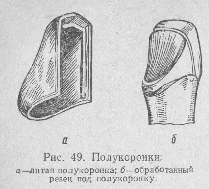 Противопоказания к изготовлению коронки. Виниры вкладки накладки полукоронки. Препарирование зубов под полукоронки. Полукоронки экваторные коронки. Шины из полукоронок в стоматологии.