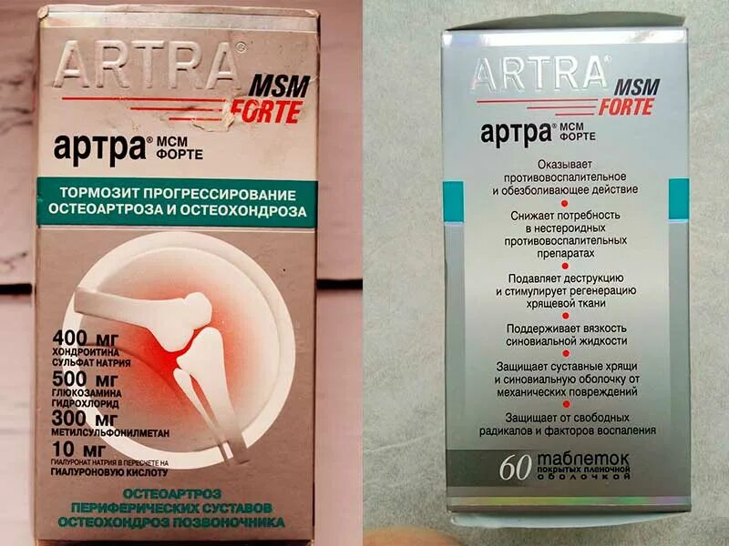 Артра актив мсм таблетки. Артра форте 120. Artra MSM Forte 300мг. Хондропротекторы для позвоночника артра.