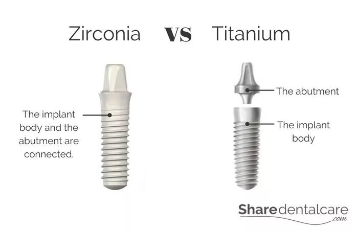 Titanium implants. Titanium fix dental implants. titanium fix dental implants set. эффект зонта имплантант. велосипед сильвер implant.