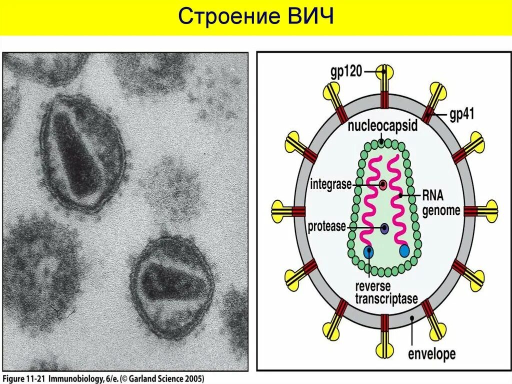 Строение вич. Вирус ВИЧ строение микробиология. ВИЧ структура вириона. Схема строения ВИЧ инфекции. ВИЧ морфология вируса.