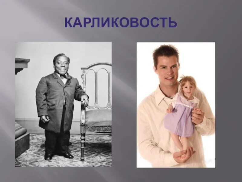 Карликовость функции. Карликовость причины и симптомы.