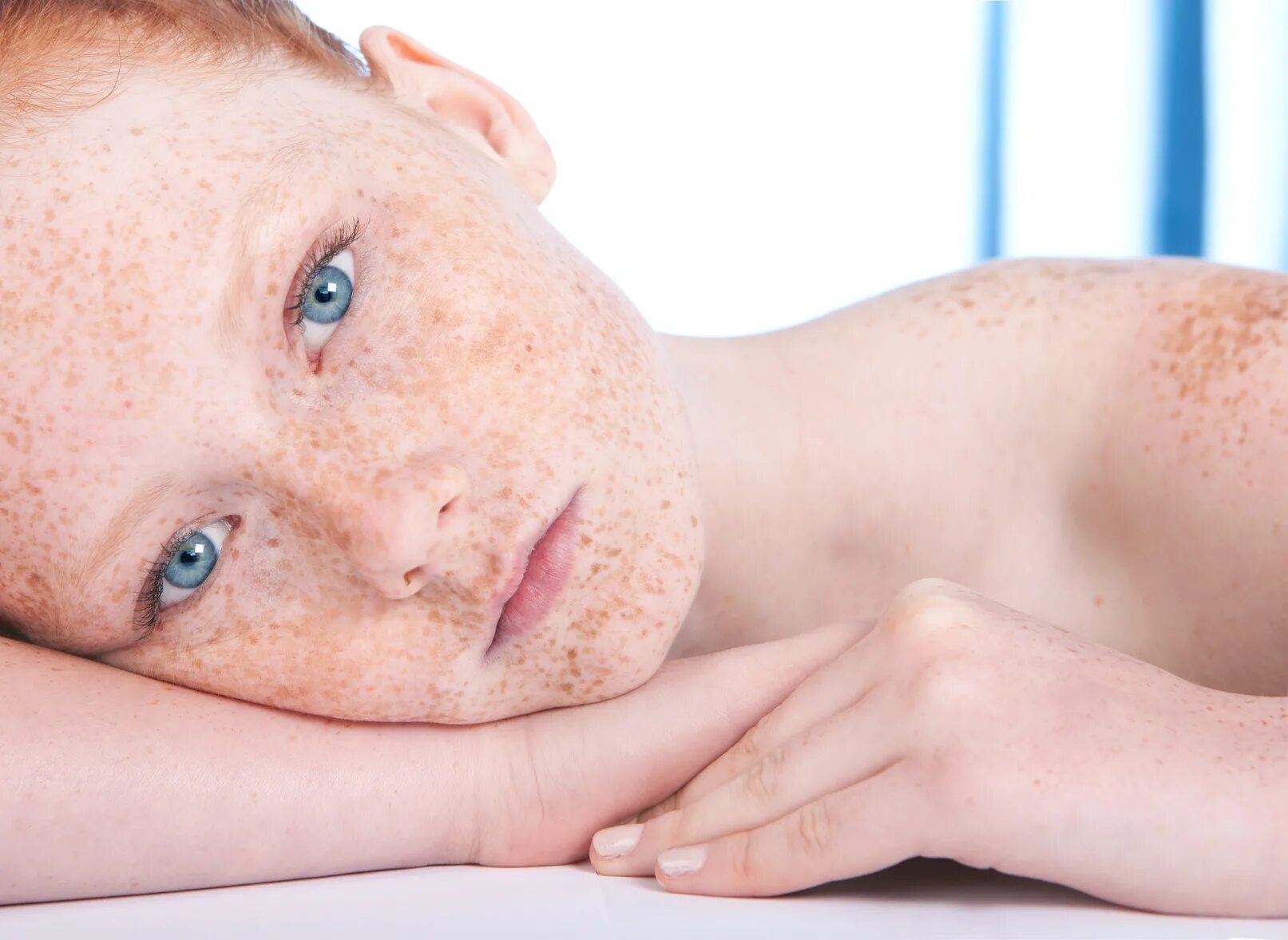 гиперпигментация у детей. пигментация на лице у ребенка. веснушки эфелиды. пигментация кожи у детей. пигментные пятна лентиго.