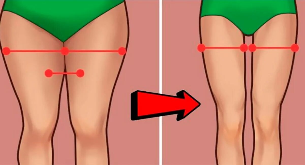 Просвет между бедрами. Ноги с просветом. Жир на внутренней стороне бедра. Ноги с промежутком.