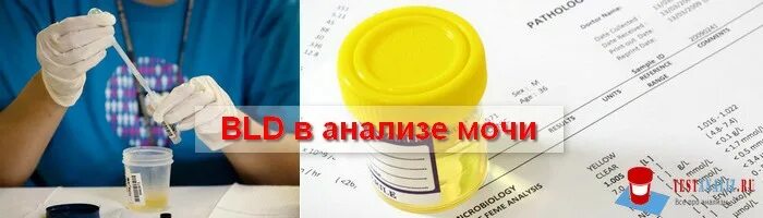 Bld в анализе мочи у женщин. Bld в анализе мочи что это. Bld в анализе мочи 10. Bld ca10 в анализе мочи. Bld CA 10 ery/ul в моче.