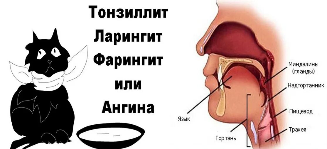 Как выглядит горло когда больно глотать Одонтогенные абсцессы и флегмоны