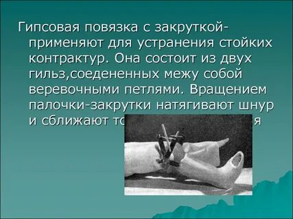 Применение гипсовых повязок