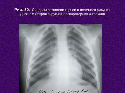 Синдром патология