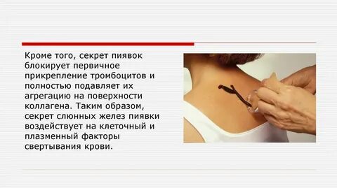 Лечебный эффект гирудотерапии выражен в тест