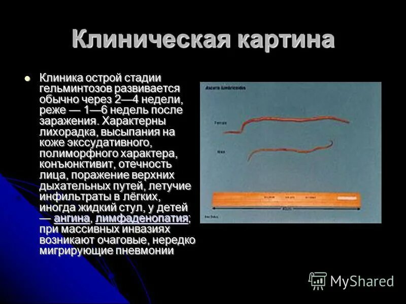 тест с ответами гельминтозы у детей