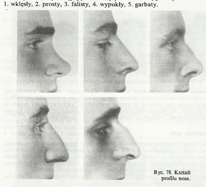 О чем говорит нос мужчины. Типы Носов с горбинкой. Различные формы носа. Формы носа в профиль. Типы формы носа.