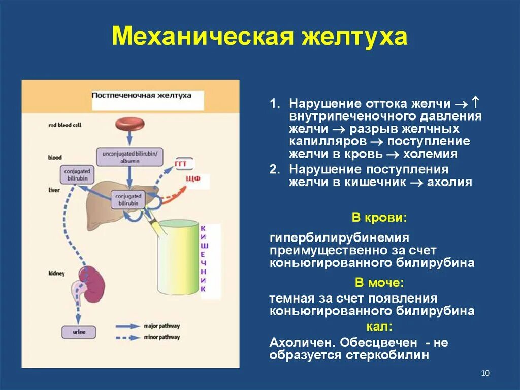 Патогенез механической желтухи биохимия. Патогенез механической желтухи патофизиология. Обтурационная желтуха этиология. Подпеченочная желтуха патофизиология.