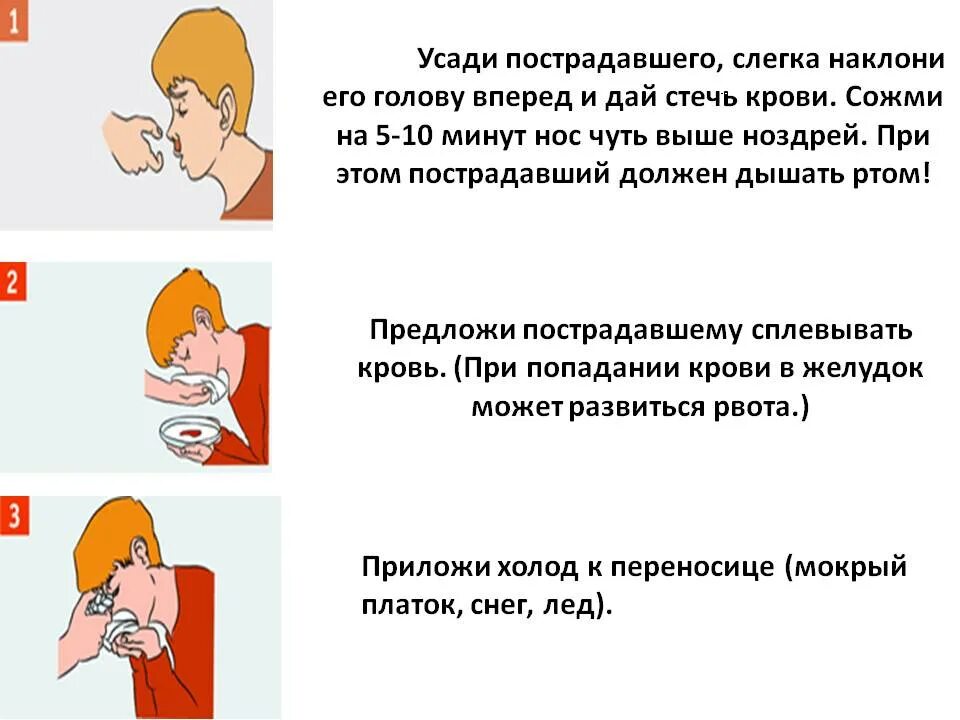 Первая помощь пострадавшему с носовым кровотечением. Оказание помощи при кровотечении из носа. При кровотечении из носа. Носовое кровотечение оказание первой помощи. Необходимые действия при носовом кровотечении:.