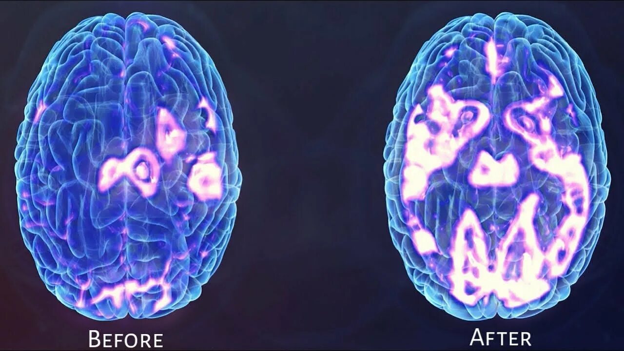 After brain. Кристальный мозг. Мозг vs нейросеть. Brain depression. Скан мозга импульсов.