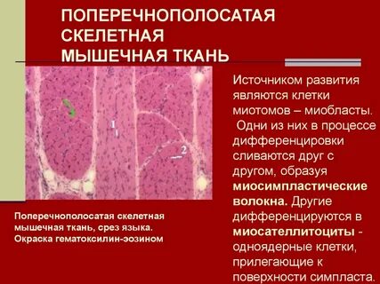 Каком органе имеется поперечно полосатая мышечная ткань