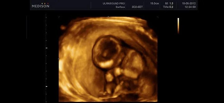 Что пишут мамы на 14 неделе беременности - Форум BabyBlog - отзывы уже беременны