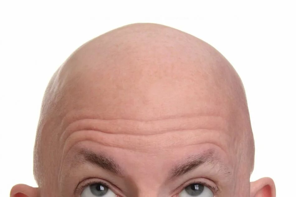 Что делает head. Мужчина задумался. Болит затылок по бокам. Височная головная боль причины. Болит голова.