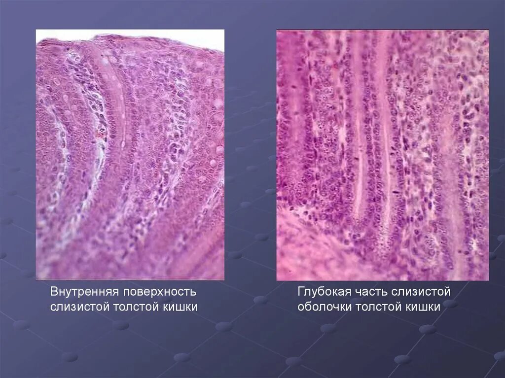 Меланоз толстой кишки гистология. Поверхность слизистой оболочки. Слизистая толстой кишки. Регенерации слизистой оболочки