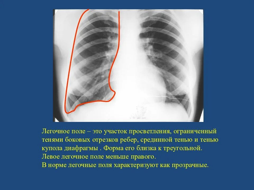 Правое легочное поле