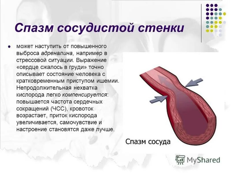 Спазм сердца. Спазм сердца