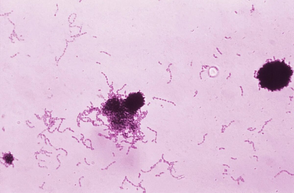 Стрептококк в микрофлоре. Streptococcus mutans эндотоксины. streptococcus mutans gram. стрептококк мутанс микробиология.