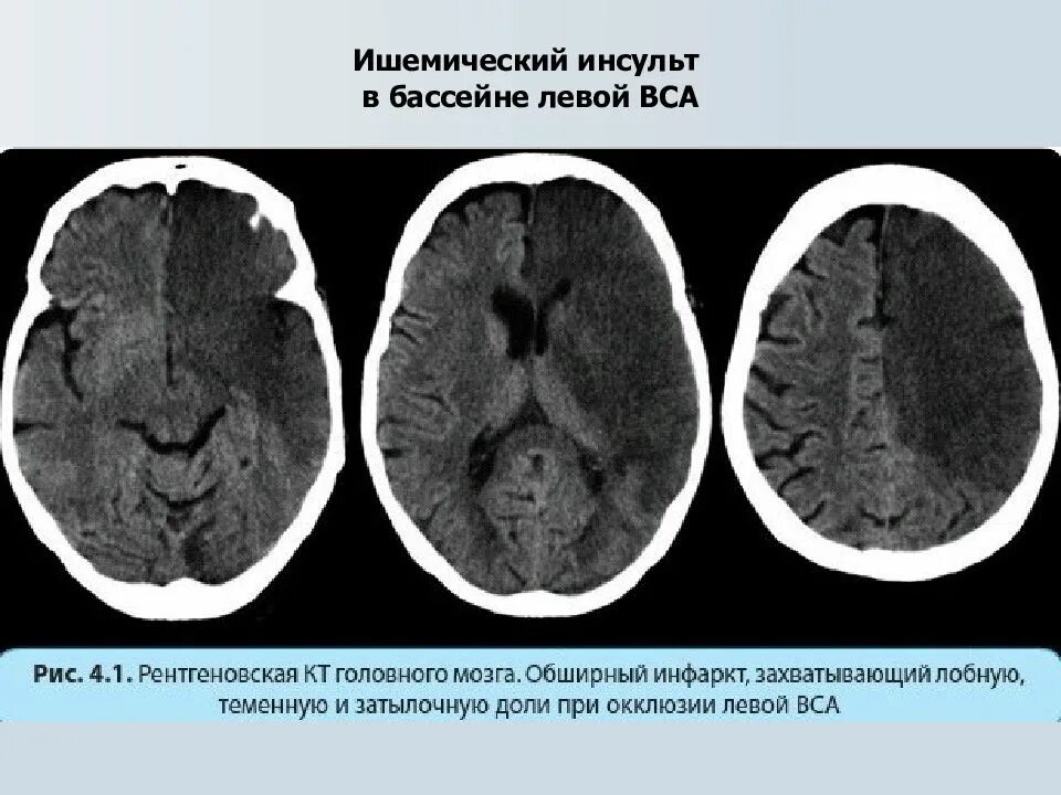 Онмк в бассейне сма