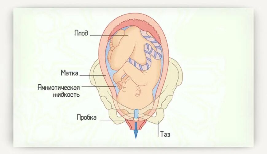 Излитие околоплодных вод период родов. Отошла пробка при родах. Слизистая пробка при беременности. Может ли начаться схватки без отхождения