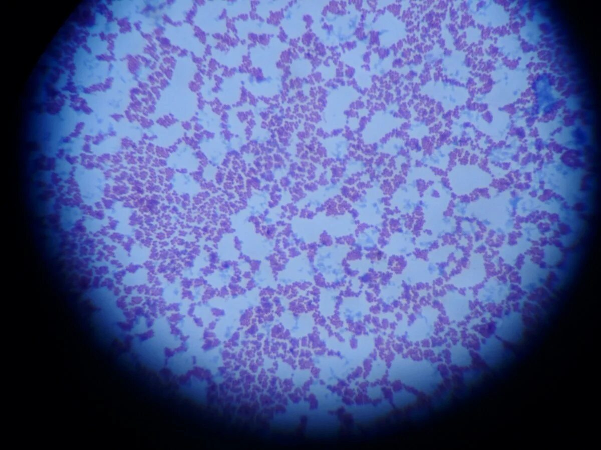 Streptococcus