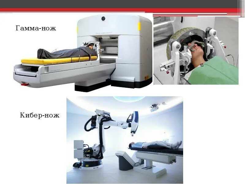 Сайт гамма нож. Стереотаксическая радиохирургия. КИБЕРНОЖ гамма нож лучевая терапия. КИБЕРНОЖ И гамма нож отличие.