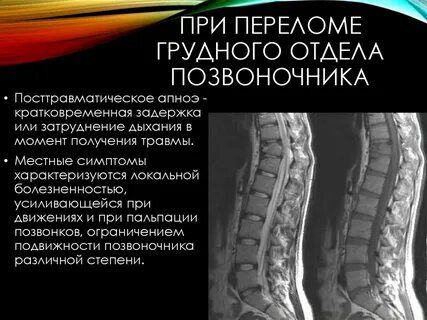 Боли при компрессионном переломе