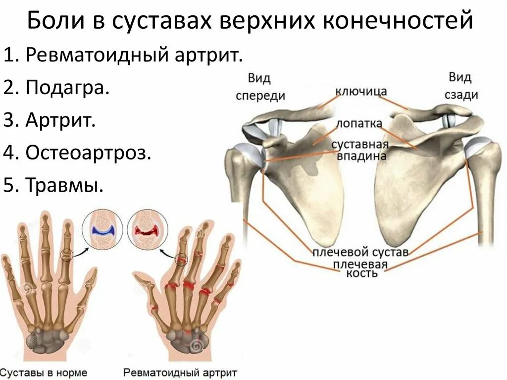 Названия суставов человека. Соединения костей пояса верхней конечности таблица. Таблица соединения костей свободной верхней конечности. Соединения костей верхней конечности таблица. Суставы свободной верхней конечности.