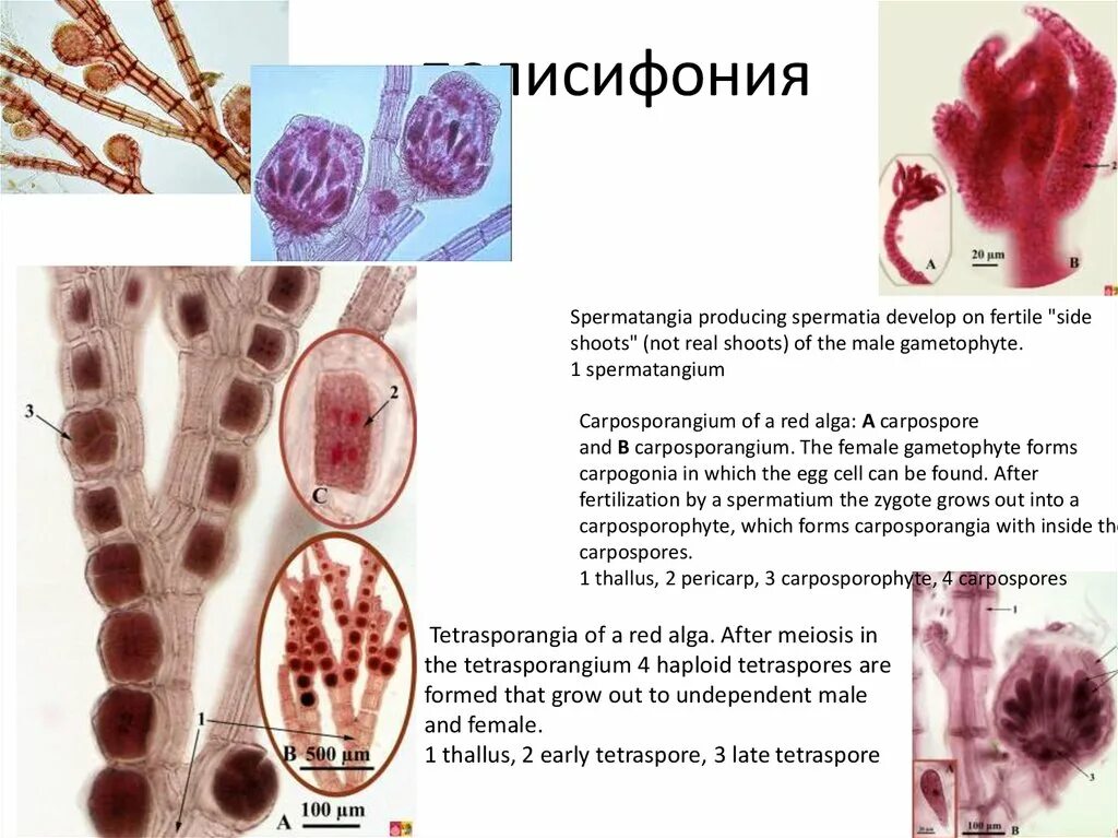 Красные водоросли клетки. Полисифония водоросль. Красные водоросли полисифония. Красные водоросли багрянки. Красные водоросли изогамия.